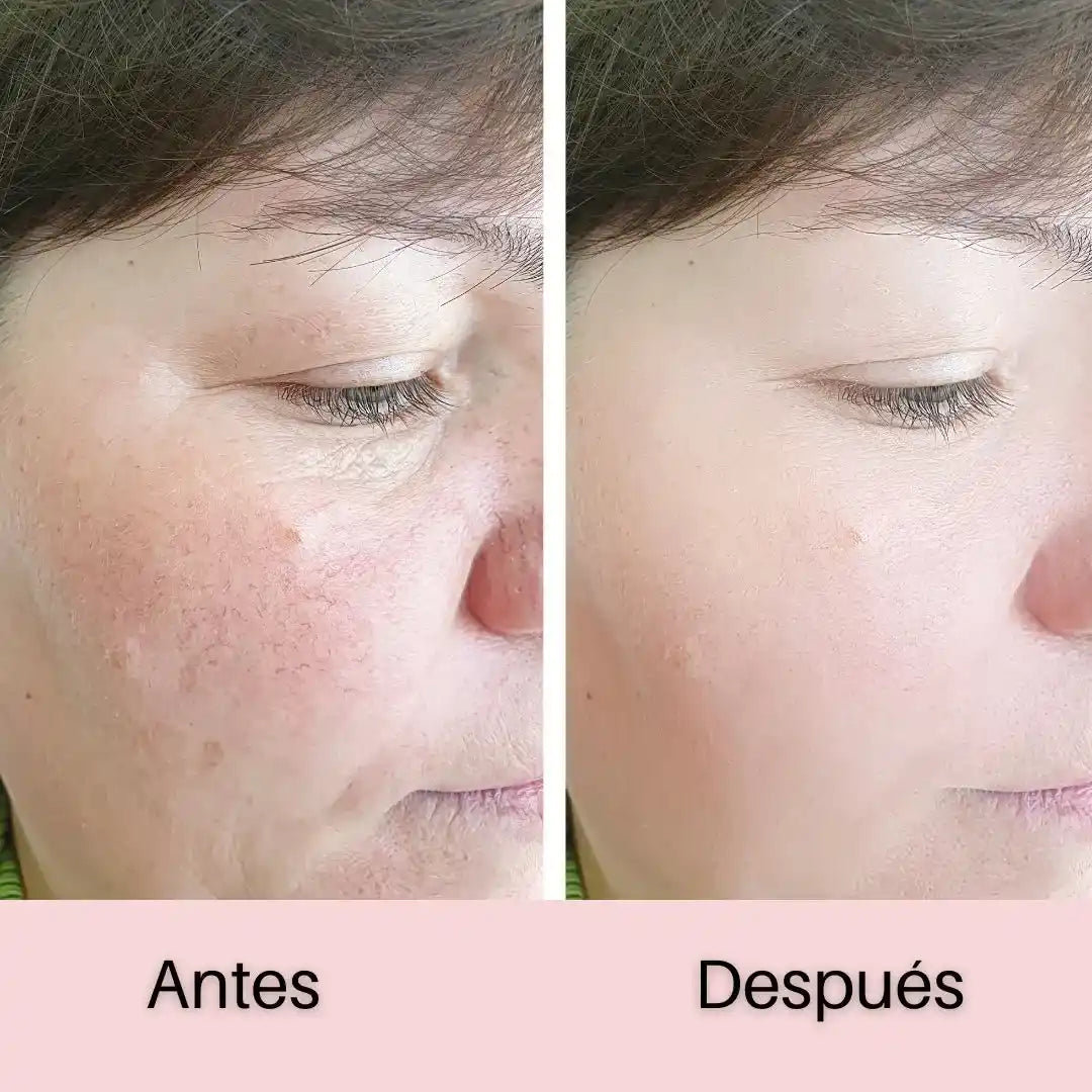 MÁSCARA FACIAL LED 7 COLORES = 7 BENEFICIOS PARA TU PIEL