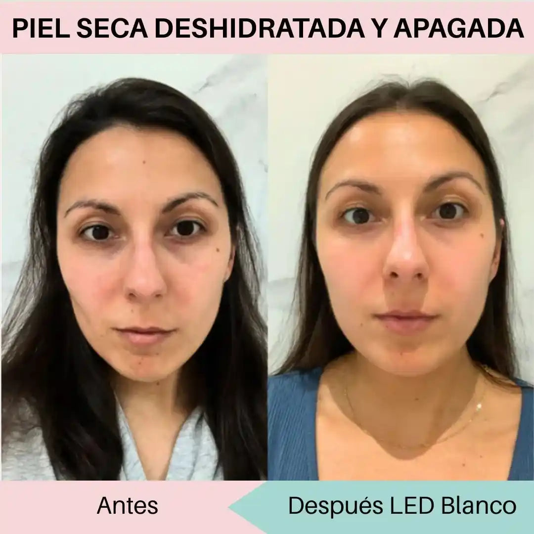 MÁSCARA FACIAL LED 7 COLORES = 7 BENEFICIOS PARA TU PIEL