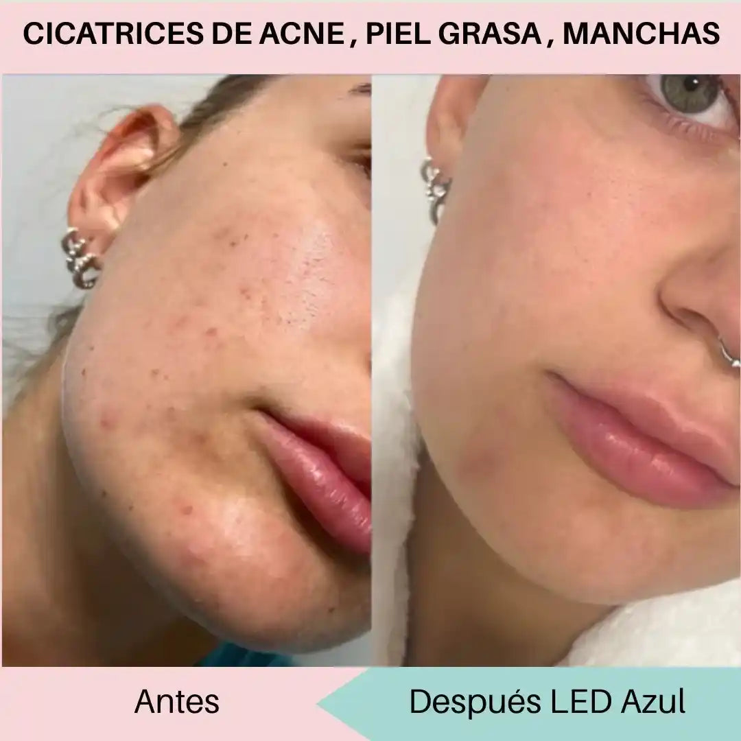 MÁSCARA FACIAL LED 7 COLORES = 7 BENEFICIOS PARA TU PIEL